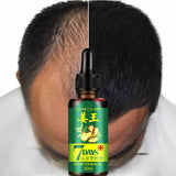 Oil Dry and Damaged Hairs Nutrition - DAWYNSALE